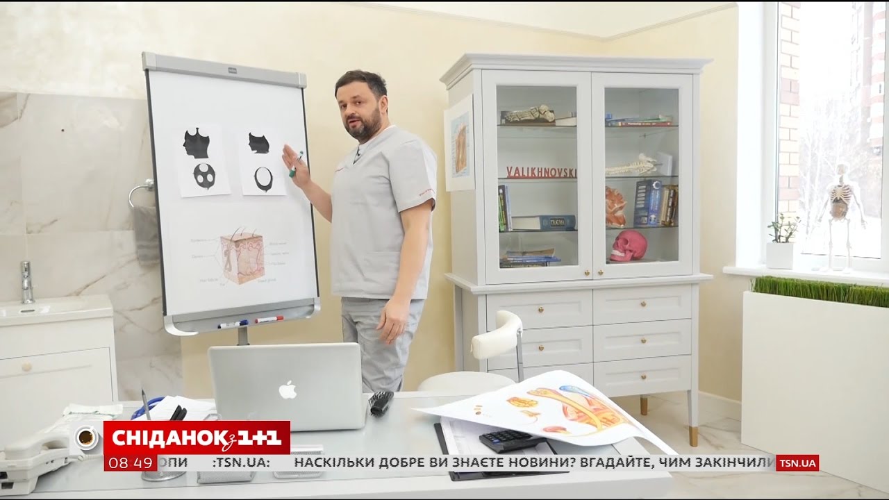 Как замедлить облысение - Доктор Валихновский