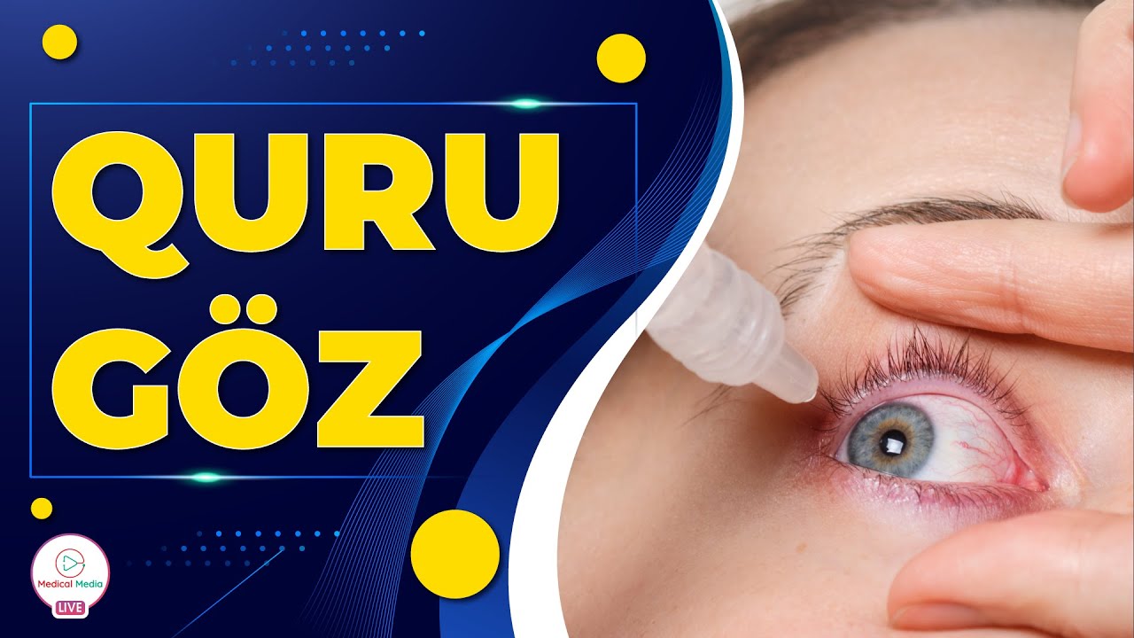 GÖZÜMÜZ NİYƏ QURUYUR? QURU GÖZ SİNDROMU NECƏ MÜALİCƏ EDİLİR?