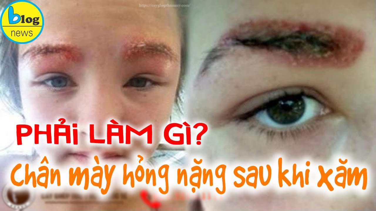 Phun xăm lông mày: Những lỗi thường gặp và cách khắc phục