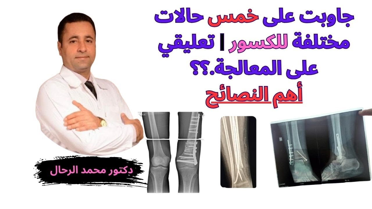 جاوبت على خمس حالات مختلفة للكسور | تعليقي على المعالجة؟؟| أهم النصائح