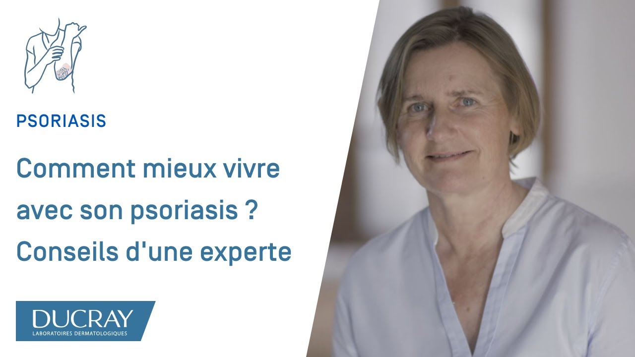 Comment mieux vivre avec son psoriasis ? Conseils d'une experte