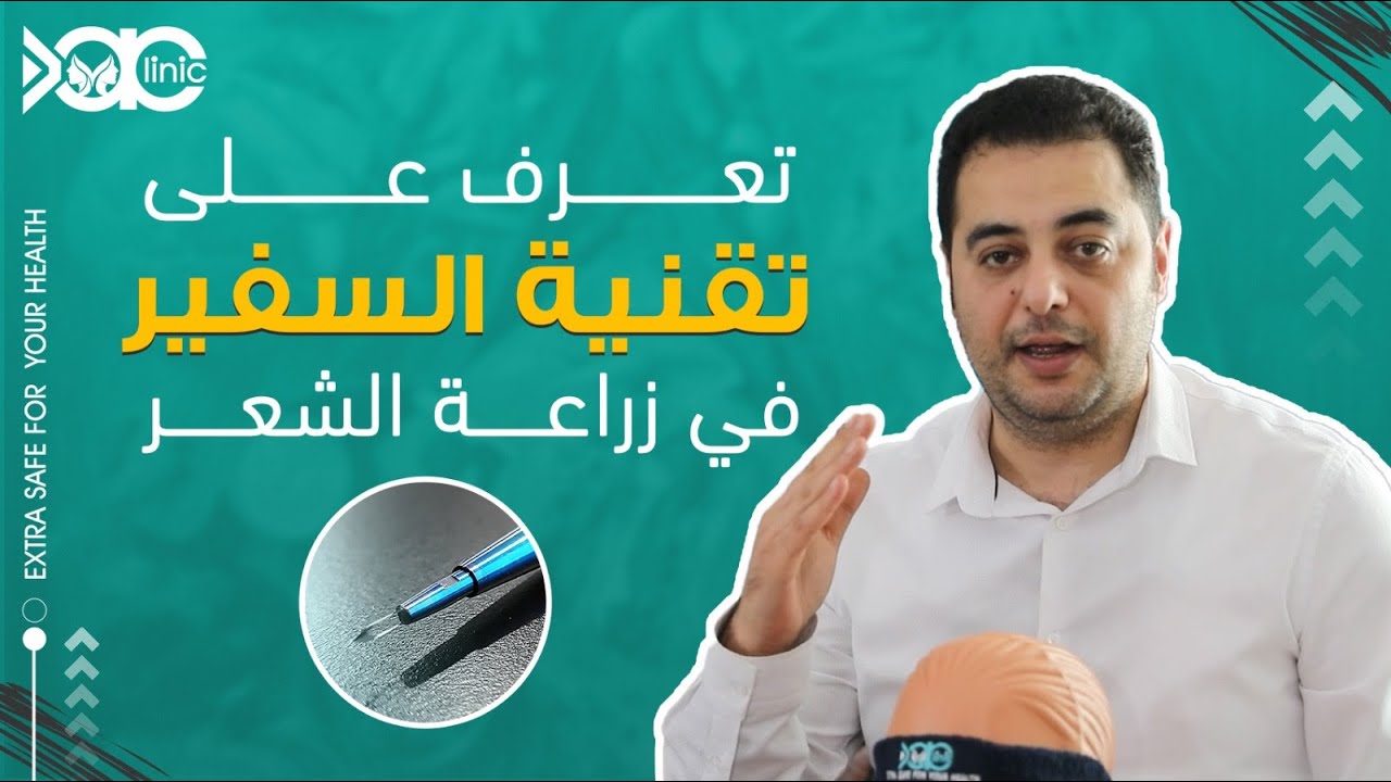 مع أكس ايه، تعرف على تقنية السفير في زراعة الشعر