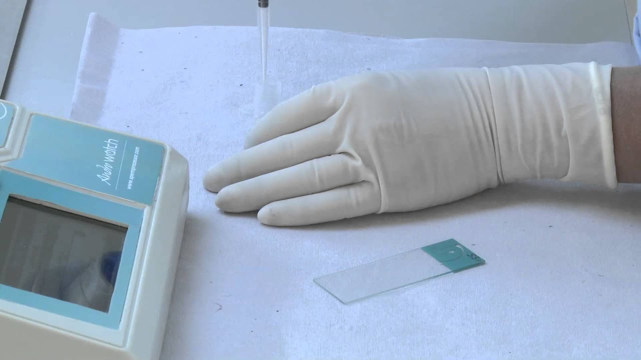 Antisperm Antibody IgG Indirect