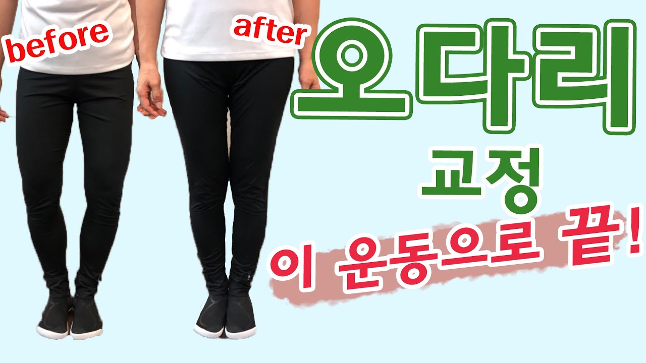 [오다리 교정운동] 효과 대박, 내 다리는 오다리! 교정은 이렇게 하세요!