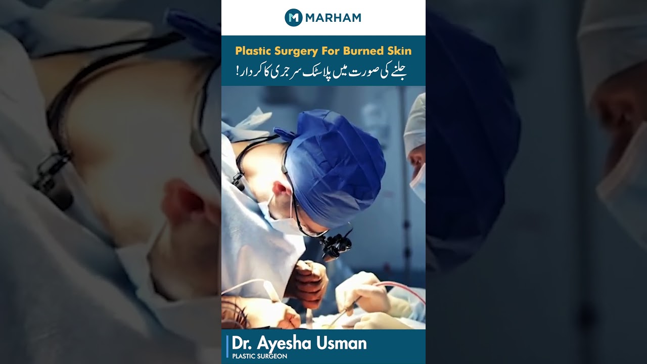 Plastic Surgery For Burned Skin | Kya Jalle Hoe Ka Ilaj Plastic Surgery Se Mumkin Hai?