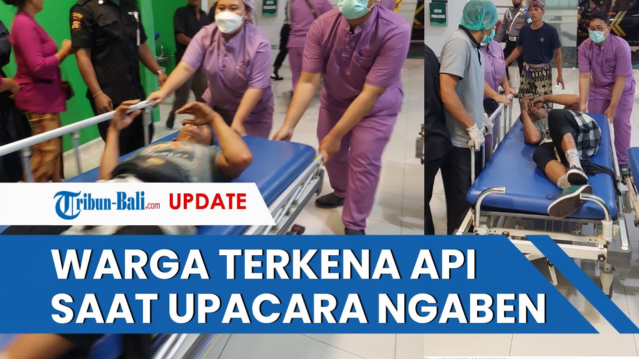 Kompor mayat Meledak, Sejumlah Warga Terbakar saat Ngaben di Blahbatuh, UGD RSUD Sanjiwani Penuh.