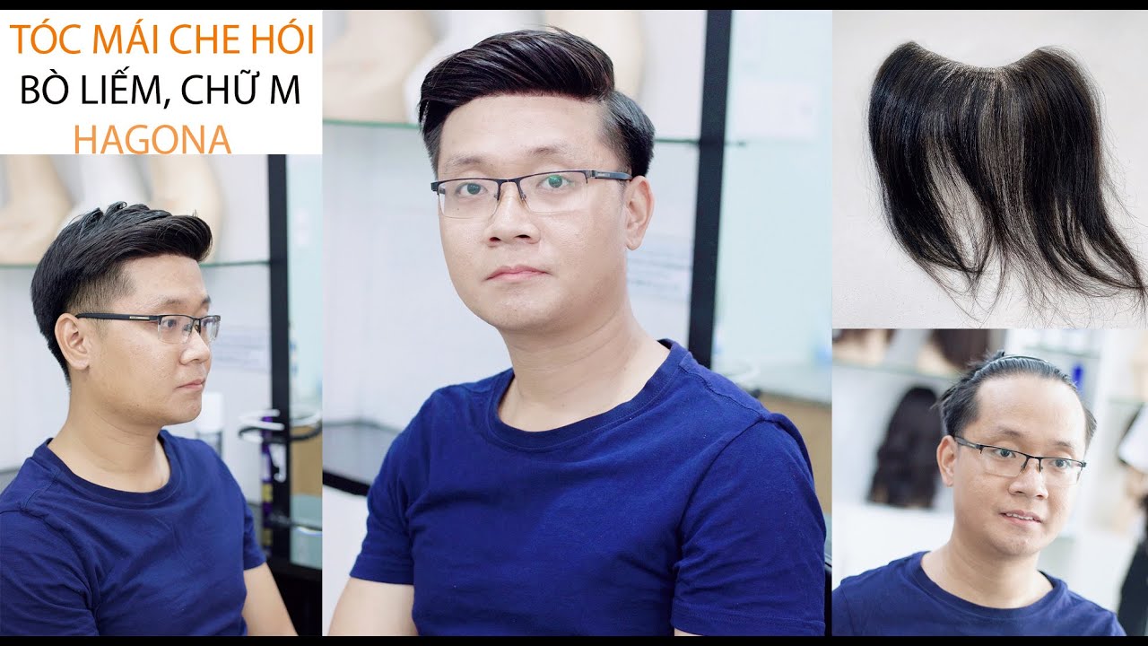 Cách dán keo và gội tóc giả mái che hói chữ M cho nam