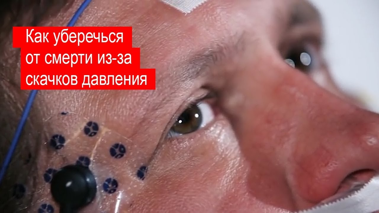 Отзыв на средство от гипертонии GIPERTOX#гипертония #лечениегипертонии#gipertox #34