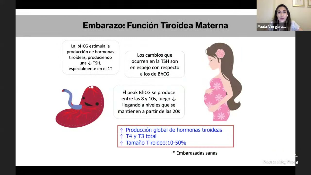 Guía Clínica Enfermedades Tiroideas en el embarazo (8 Jornada MMF HCUCH 2021)