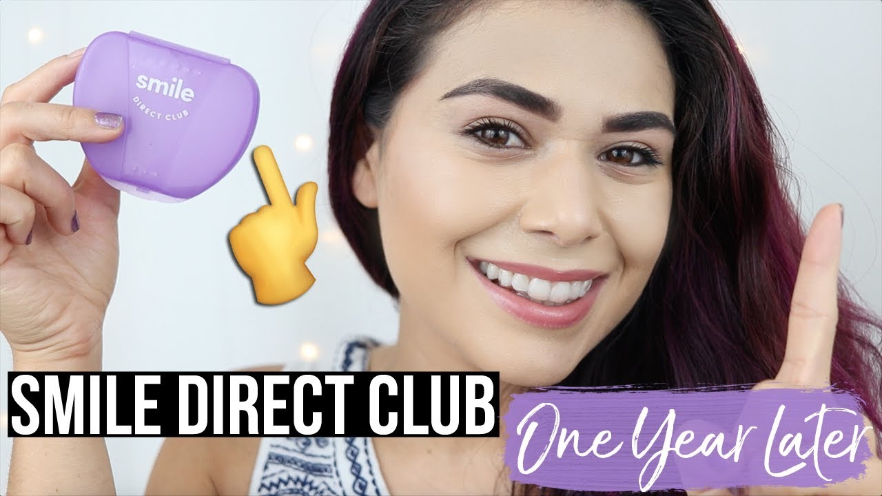 ONE YEAR LATER: SMILE DIRECT CLUB UPDATE | Aligner Routine