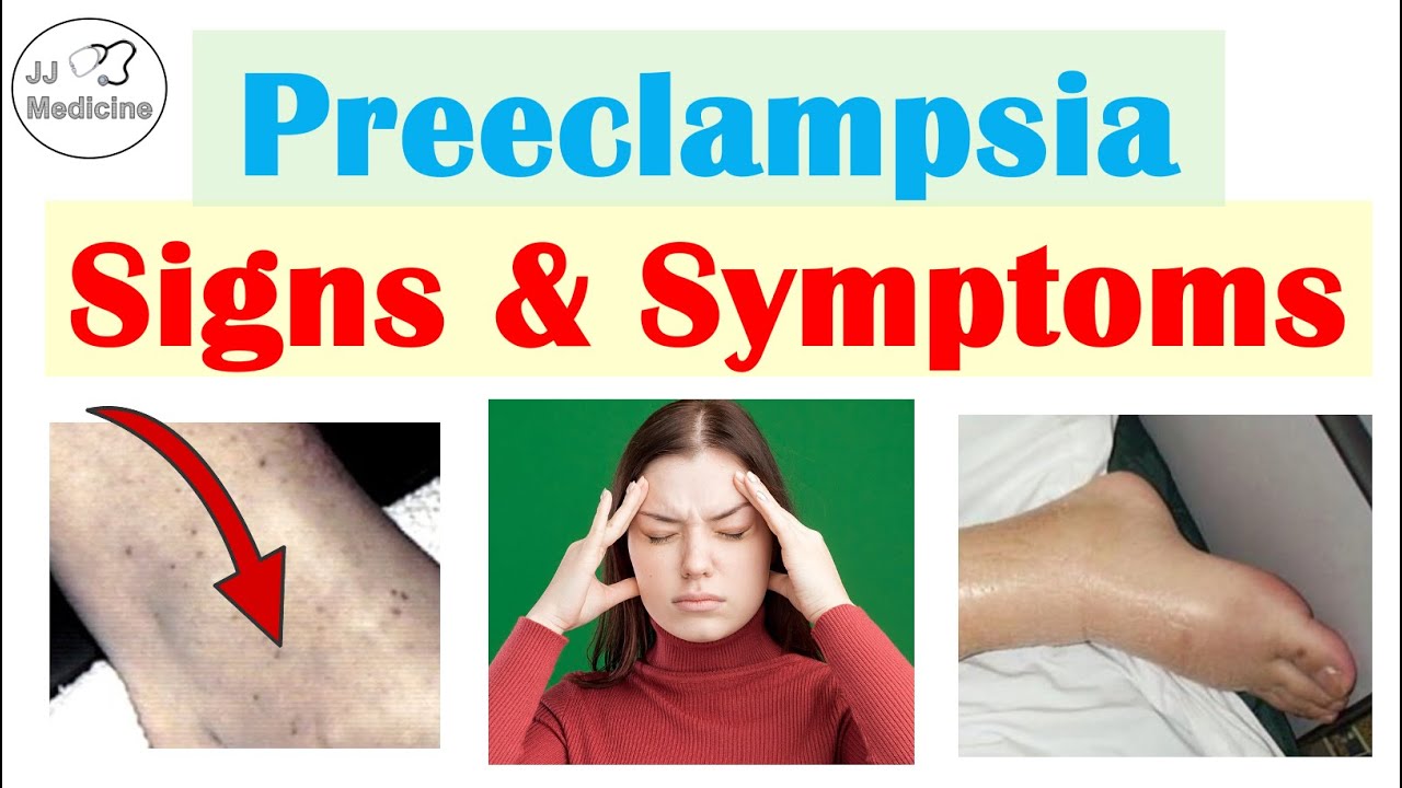 Preeclampsia: Signs & Symptoms You Have To Watch Out For