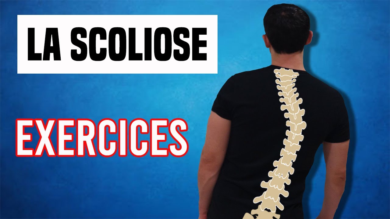 SCOLIOSE : SOLUTIONS ET EXERCICES POUR LA TRAITER