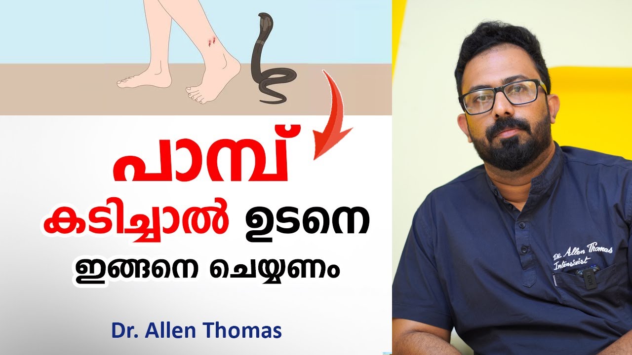 പാമ്പ് കടിച്ചാൽ ഉടനെ ഇങ്ങനെ ചെയ്യണം | snake bite first aid | Dr. Allen Thomas