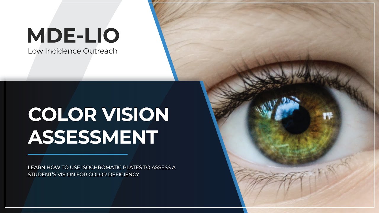 Color Vision Assessment