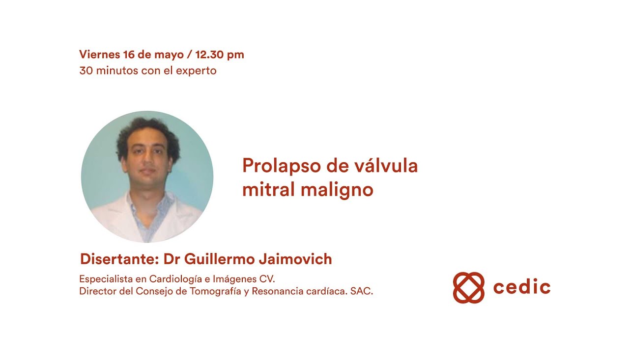 Prolapso de válvula mitral maligno