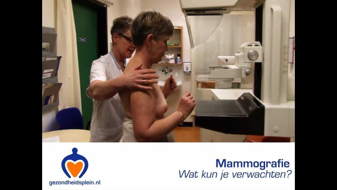 Mammografie - Wat kun je verwachten bij dit borstonderzoek?