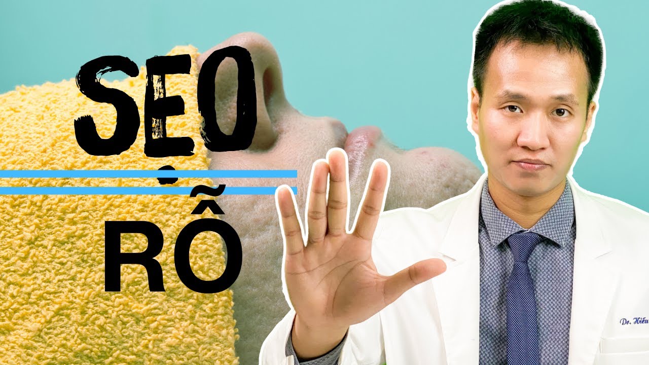 Sẹo lõm - Sẹo rỗ KHỎI được bao nhiêu % - Phụ thuộc vào các yếu tố mà BẠN KHÔNG hề hay biết | Dr Hiếu