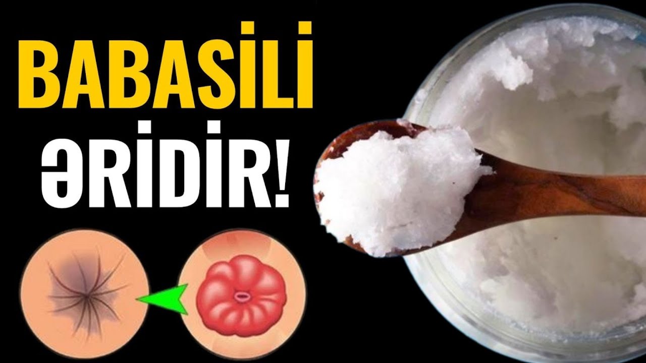 Babasil 3 G&Uuml;NƏ necə sağalır? - Rahatlıq tapacaqsız