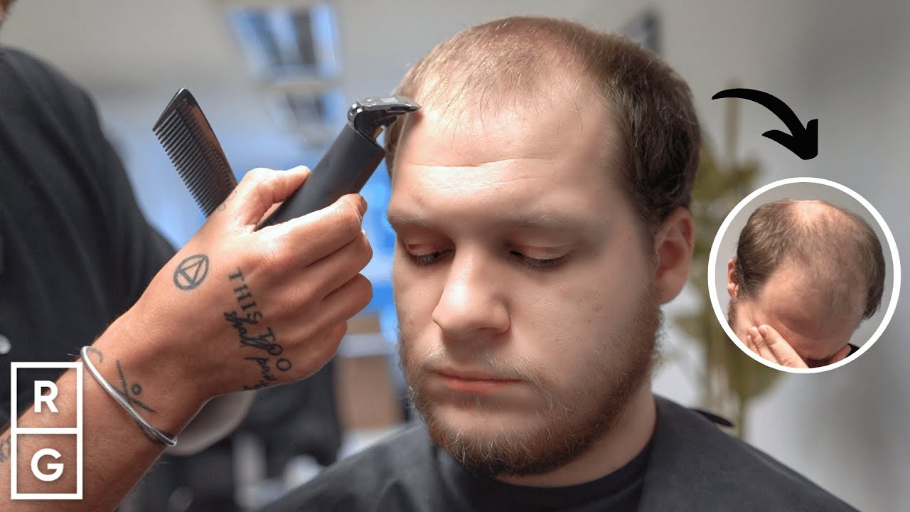“I Can Go Outside WITHOUT a Hat NOW!” Haircut after HIDING Thinning Hair | Talking Hair Loss