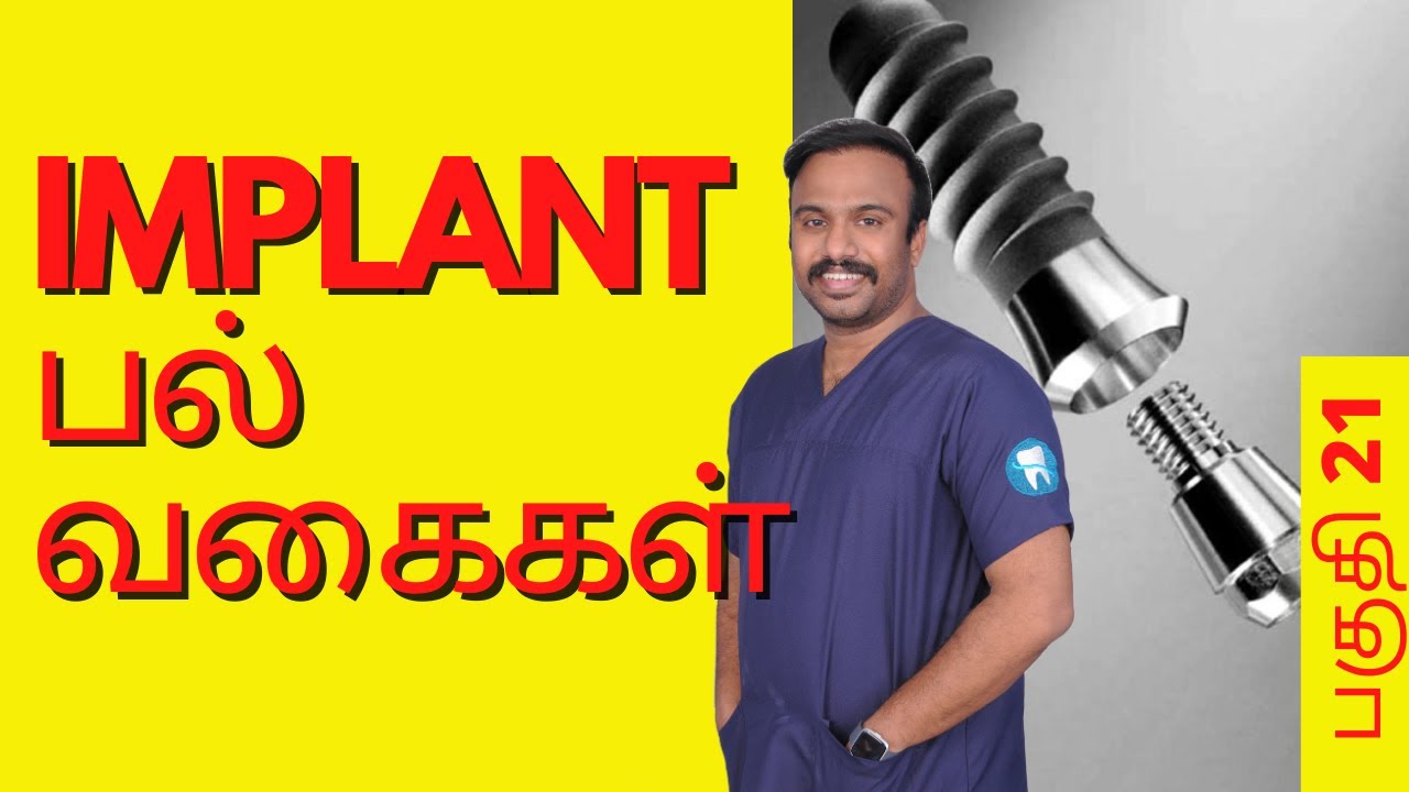 Implant பல் வகைகள் | Types of Implant-Supported Teeth | Best Implantologist in Tamil Nadu 2021