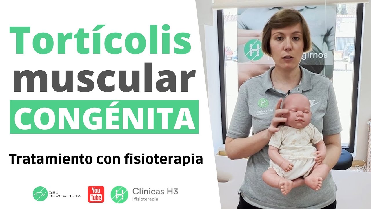 Tratamiento tortícolis muscular congénita 👶| Clínica H3 fisioterapia [2024]