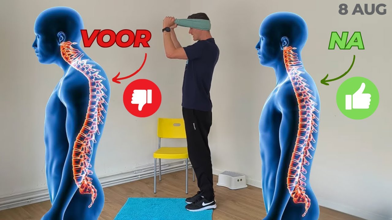 Oefeningen om een bolle rug of KYFOSE terug goed te krijgen - hyperkyfose - computerbochel.