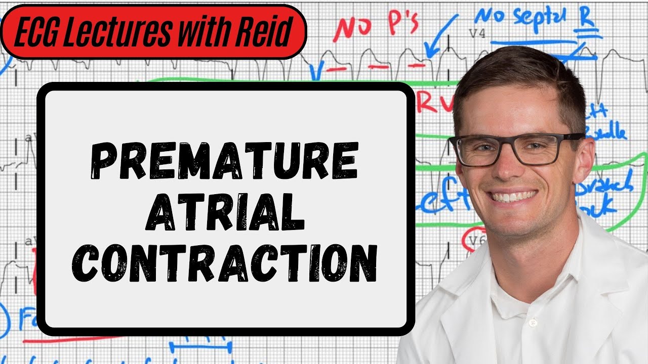 Premature Atrial Contractions | Day 2 ECG Challenge