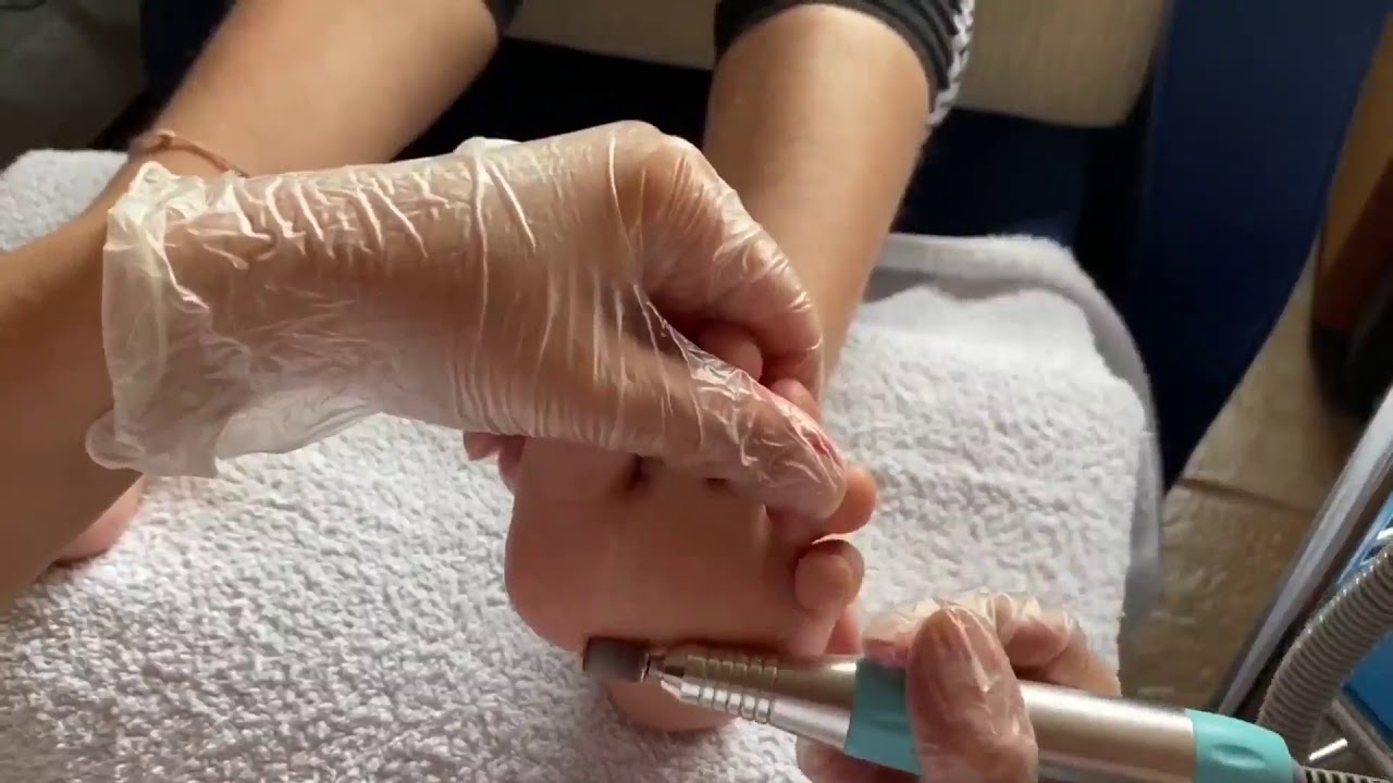 17 PEDICURA CON TORNO
