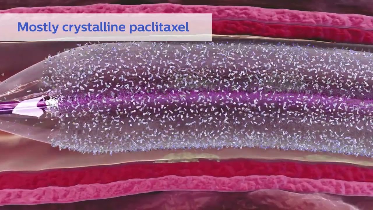 Stellarex drug-coated angioplasty balloon product animation