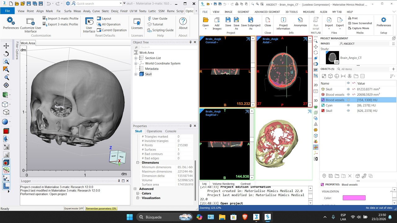 🧬 Materialise Mimics Medical 26.0 + Materialise 3-matic 18.0.0.1645 🧬