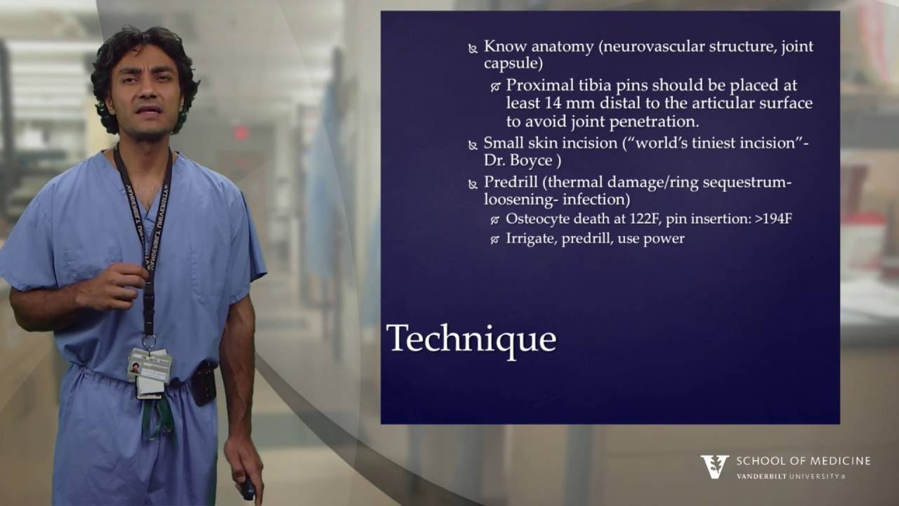 Basics of External Fixation