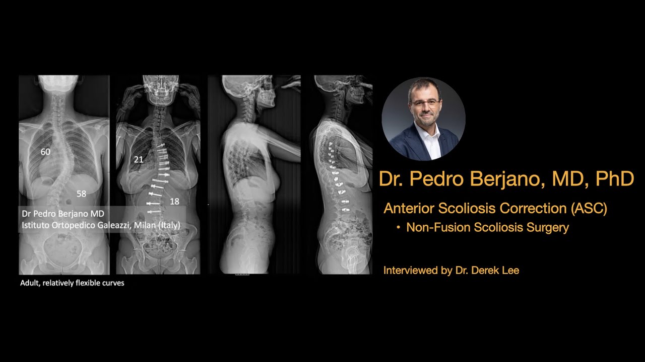 Dr. Pedro Berjano, MD, PhD, Anterior Scoliosis Correction (ASC) Non-Fusion Scoliosis Surgery.