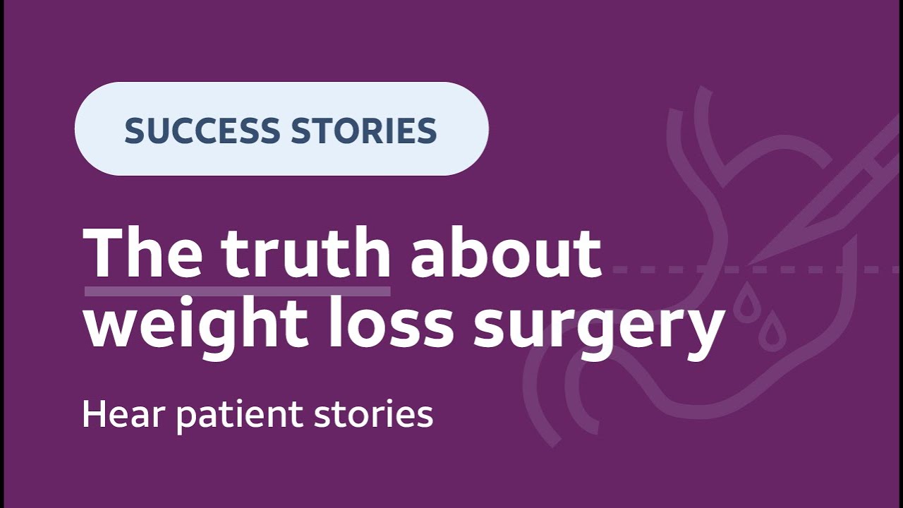 Weight Loss Surgery the truth 👉 Patient stories about weight loss surgery 🩺