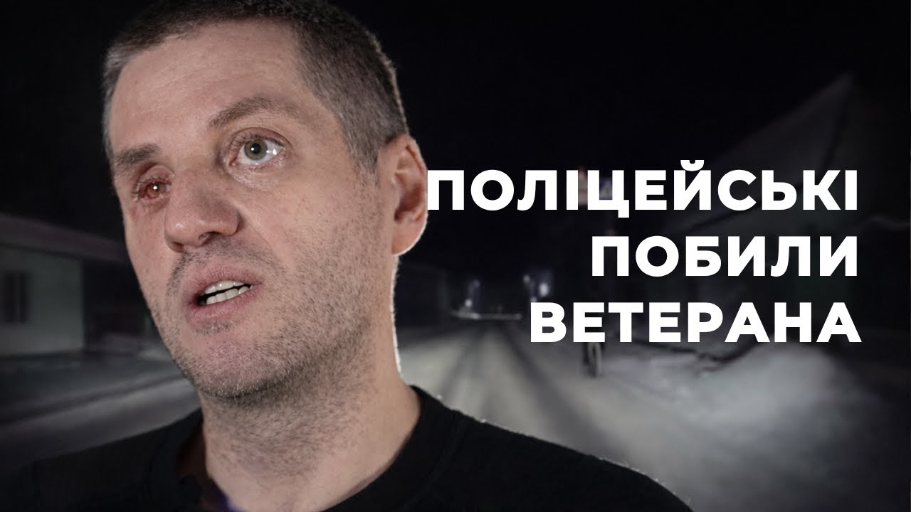 Били по голові й вибили протез ока: у Чернігові ветеран звинувачує патрульних поліцейських у побитті