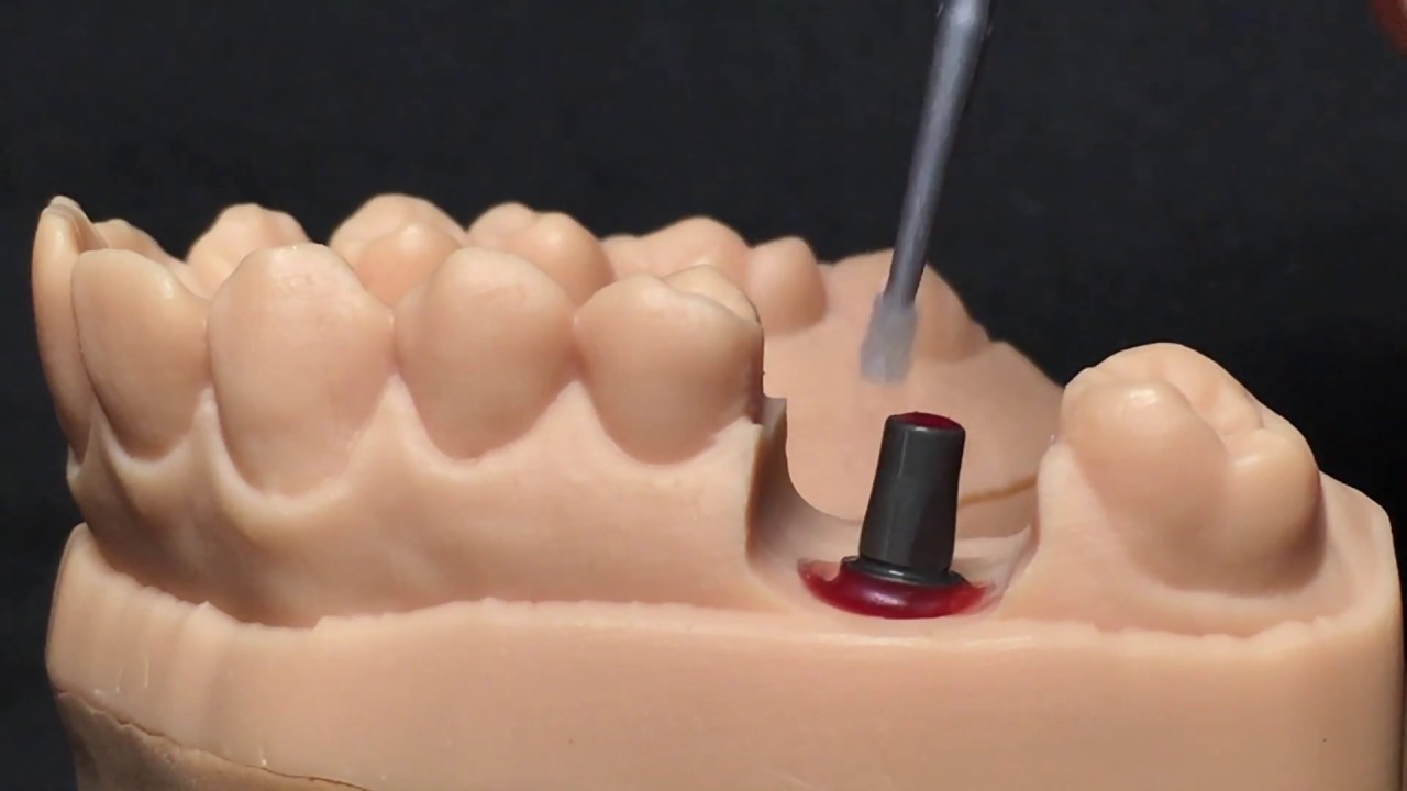 KATANA: incollaggio su impianti con PANAVIA V5