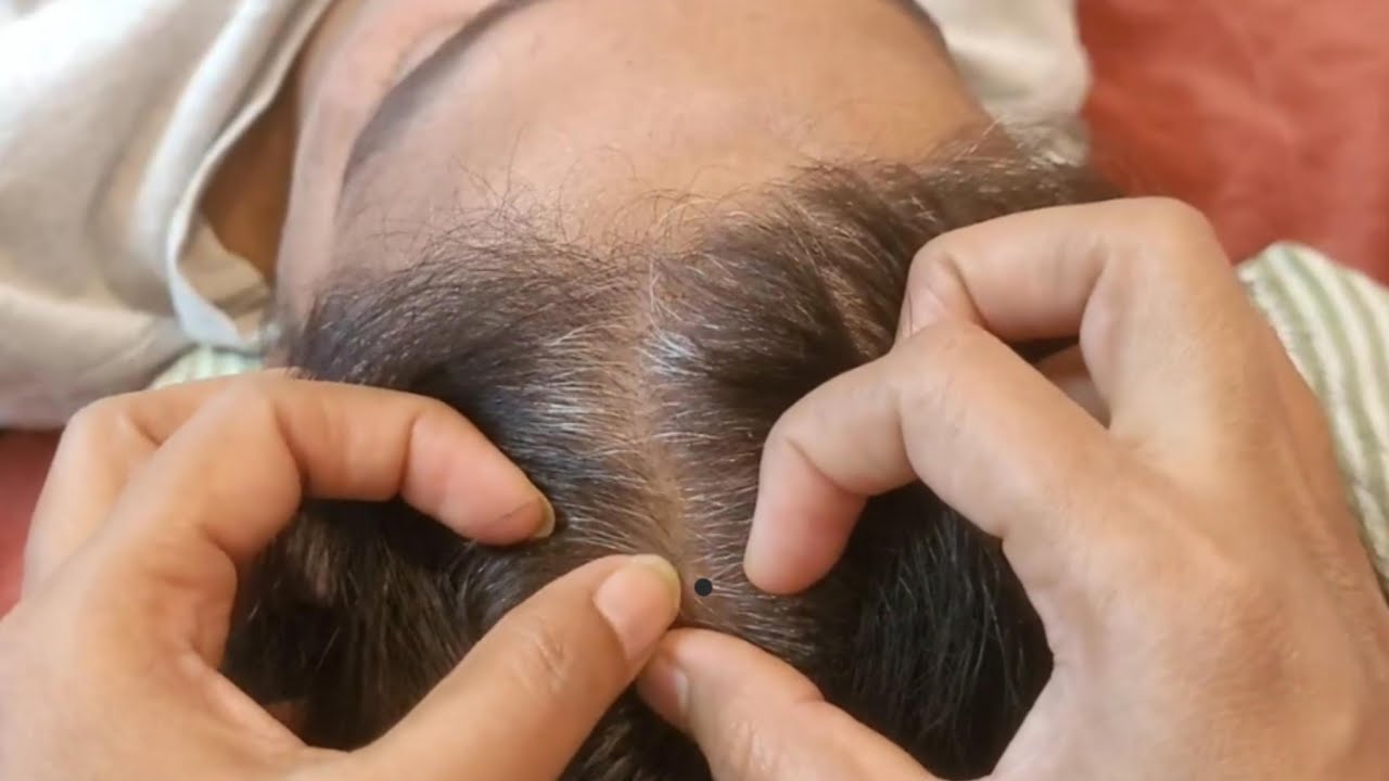 Scalp Check ASMR - The Soothing Science of Tingles✨