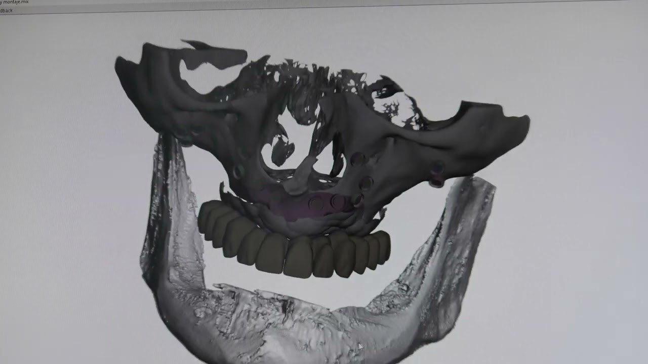 Proyecto CESEAND Plus: Casos de éxito. Medicalfit