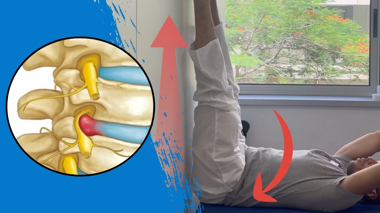 ✅ 6 BEST Exercises to Fix L4-L5 & L5-S1 Herniated Disc (Sciatica Relief)