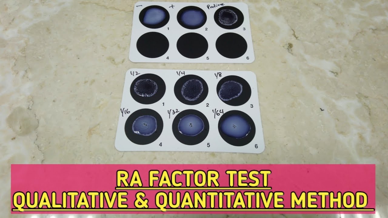 RF(Rheumatoid Factor) test.how to perform RF qualitative & quantitative method.step by step explain.