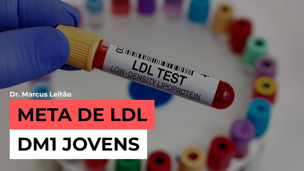 Case Meta de LDL em pacientes com DM1 jovens | Marcus Leitão | Endocrinologia descomplicada