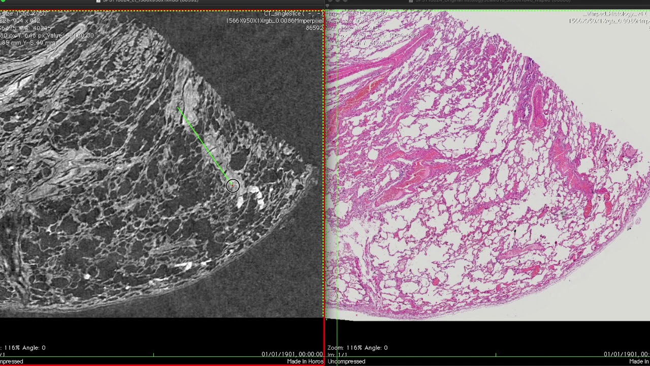 3D X-ray Histology - Simultaneous visualization of &mu;CT and H&E histology slice