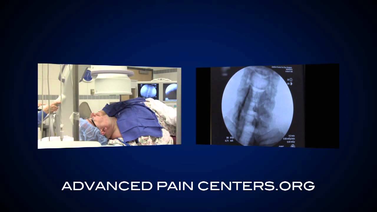 Advanced Pain Centers Spotlight Therapy: SGB For PTSD