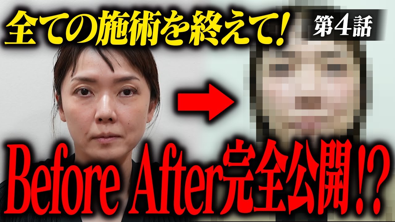 ついに完結。Before After完全公開【最終話】