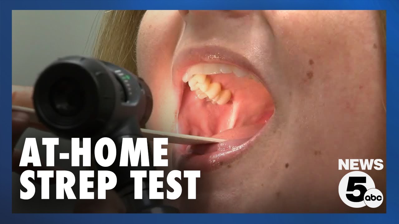 Ground-breaking research underway to test for strep throat at home