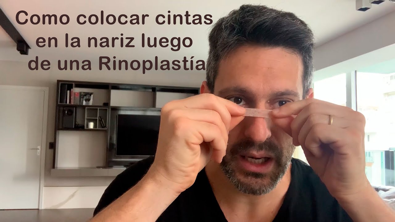 Como colocar las cintas en la nariz después de retirar la férula de la Rinoplastía. Dr. Chinski