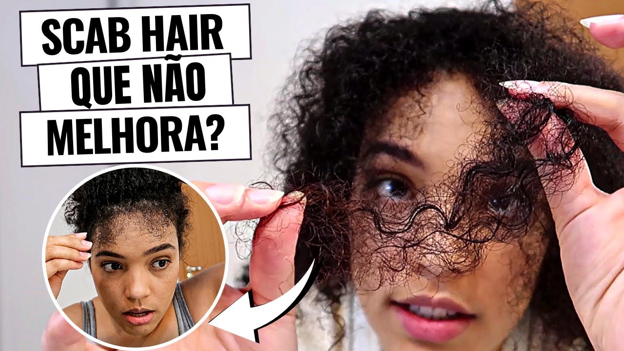 SCAB HAIR THAT NEVER GETS BETTER! WHY DO I HAVE SCAB HAIR IN MY NATURAL HAIR? | Andreza Siqueira