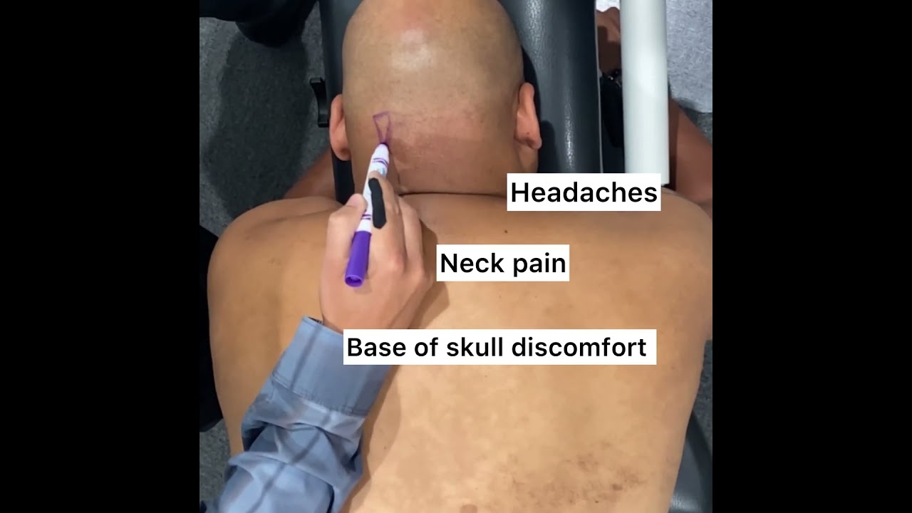 Neck Pain Relief | Neck Pain Soreness | Redondo Beach Chiropractor