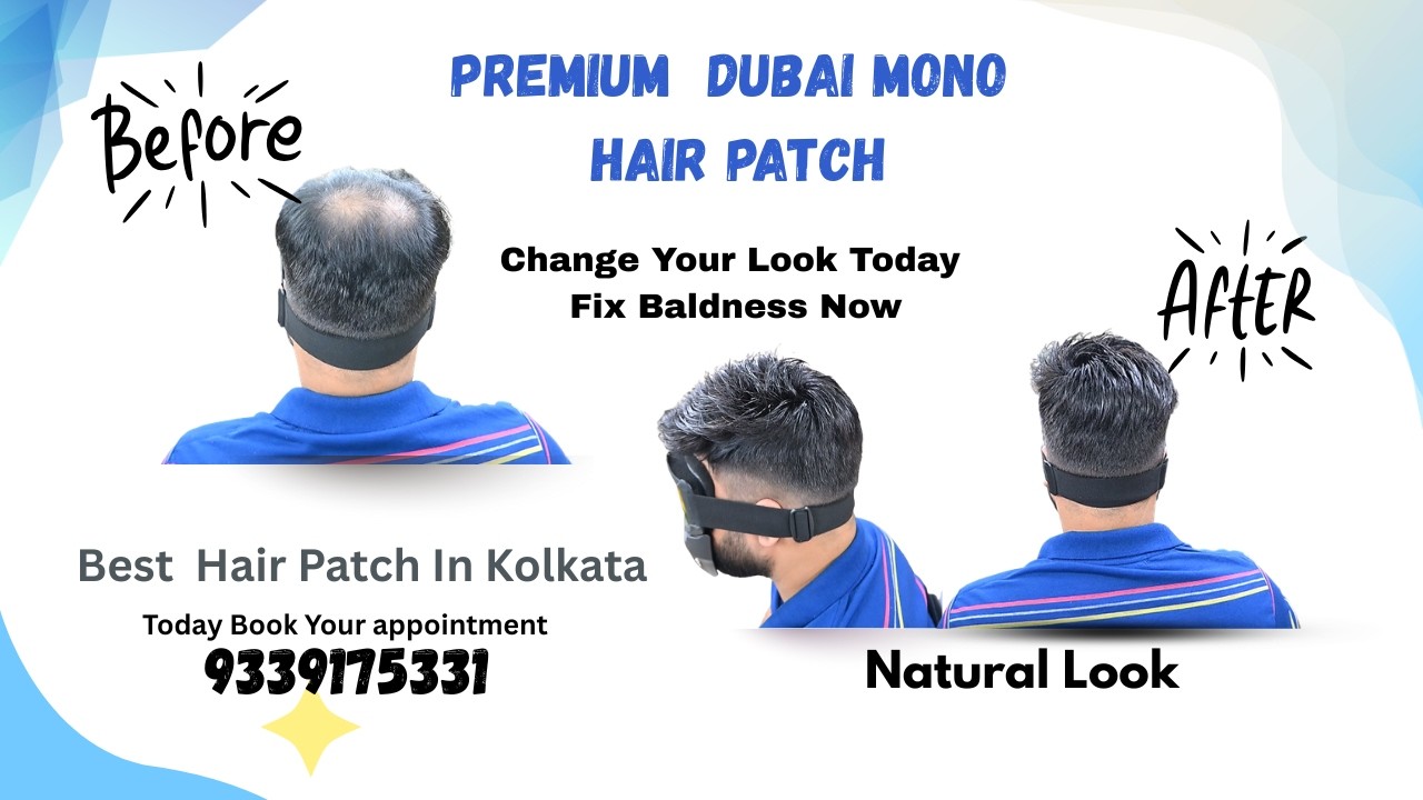 Change Your Look Now | Real Baldness Transformation Without Surgery | Kolkata Hair Experts