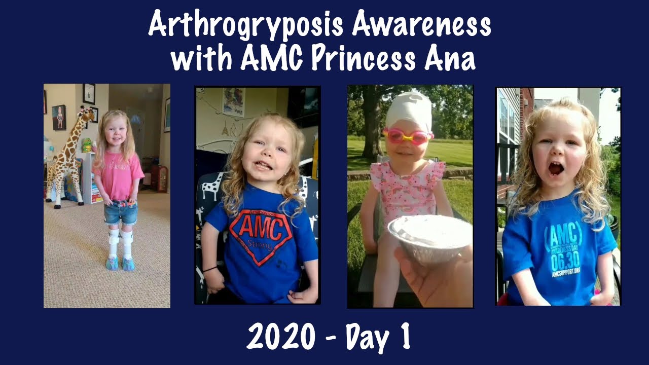 2020 Arthrogryposis Awareness with AMC Princess Ana - Day 1