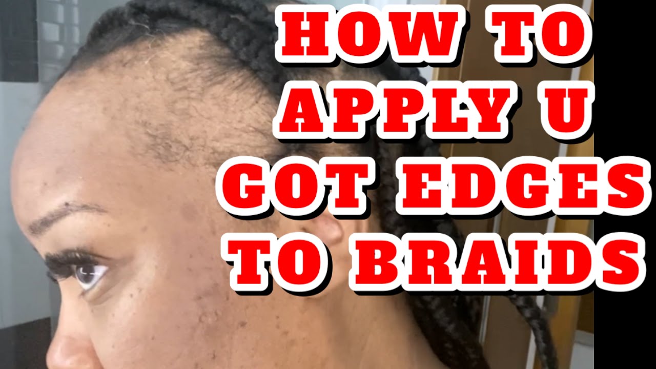 HOW TO COVER BALD SPOTS or NO EDGES • U GOT EDGES x BRAIDS | Severe Alopecia | Instant Edges